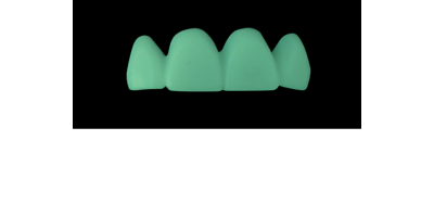 Cod.C1Facing : 10x  wax facings-bridges,  LARGE, Tapering ovoid, TOOTH 13-23, compatible with Cod.A1Lingual,TOOTH 13-23 for long-term provisionals preparation